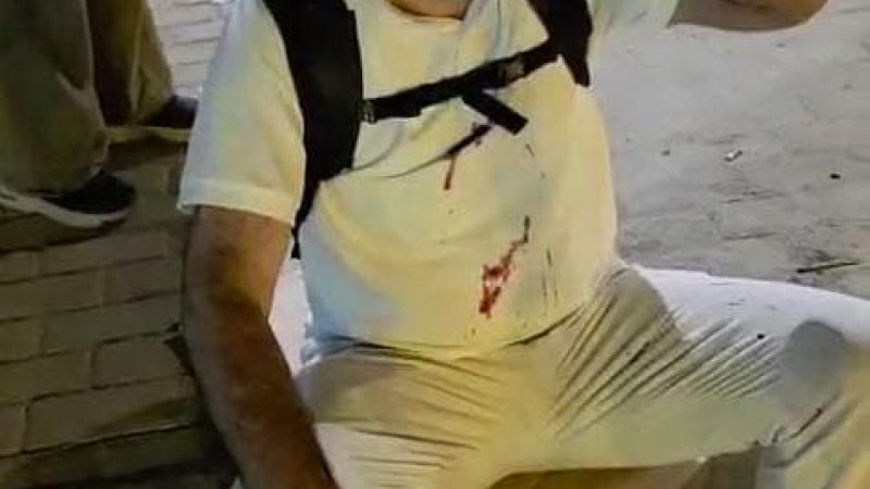 HÜDA PAR Milletvekili Dinç Mısır’da saldırıya uğradı