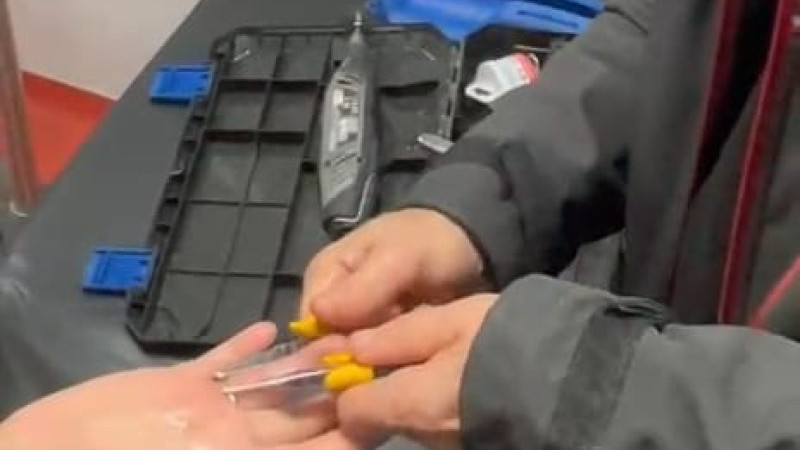 TİTİZ ÇALIŞMAYLA PARMAĞINDAKİ YÜZÜK ÇIKARILDI